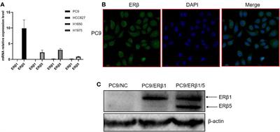 Estrogen Receptor β1 Expression Patterns Have Different Effects on Epidermal Growth Factor Receptor Tyrosine Kinase Inhibitors’ Treatment Response in Epidermal Growth Factor Receptor Mutant Lung Adenocarcinoma